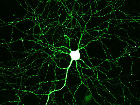 Neurons In The Brain. network of rain neurons