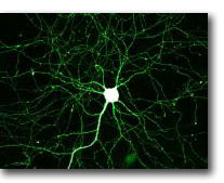 Hippocampal neuron expressing Green Fluorescent Protein